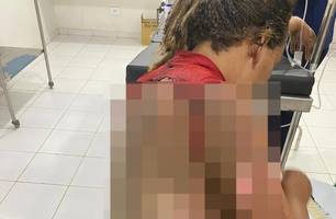 Homem é preso suspeito de atear fogo na companheira enquanto ela dormia no Piauí (Foto: Reprodução)