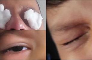 Reação sofrida pelas crianças (Foto: Reprodução)