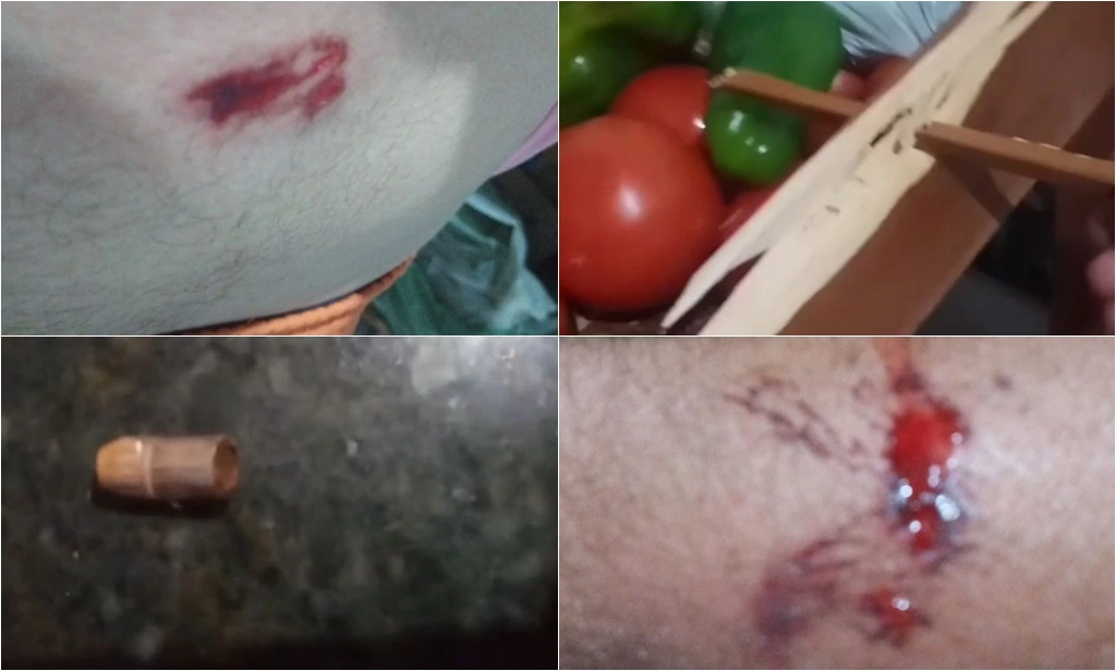 Comerciante é baleado no seu estabelecimento durante assalto em Parnaíba