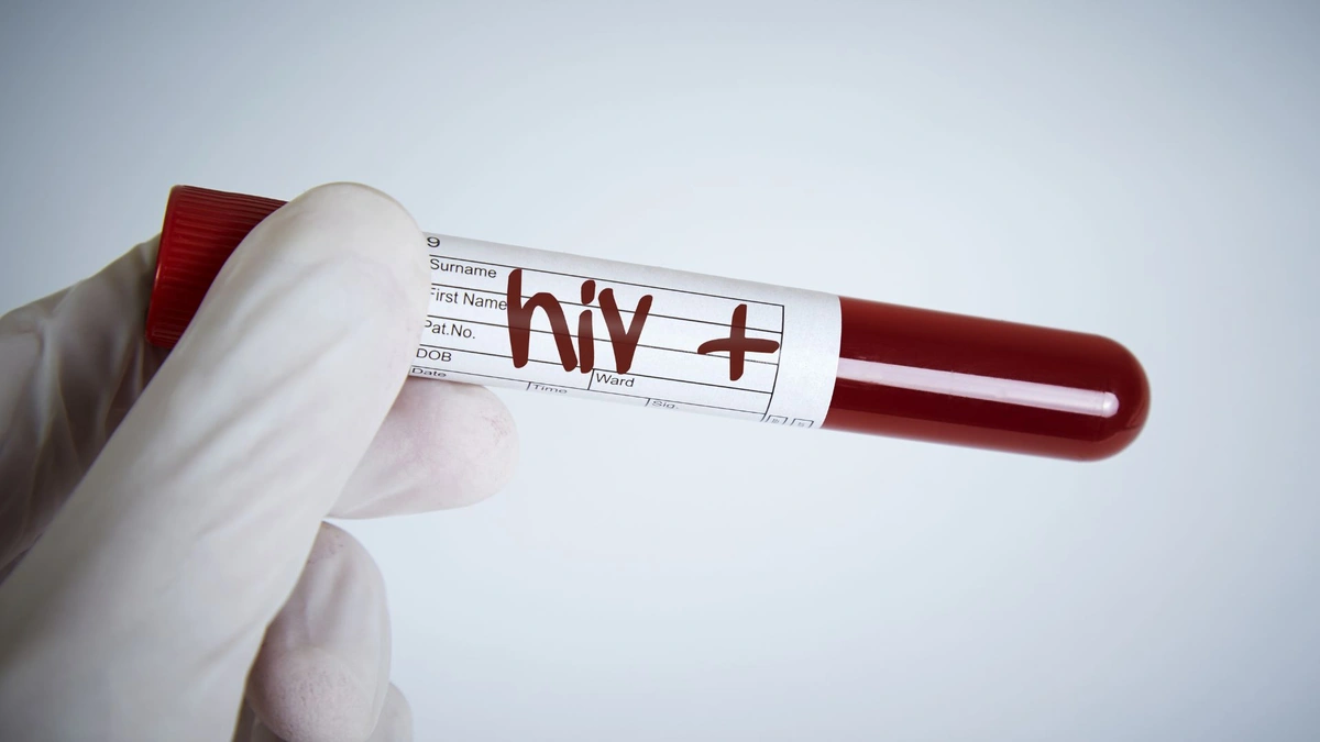 Dezembro Vermelho alerta para aumento de casos de Aids em jovens no Piauí