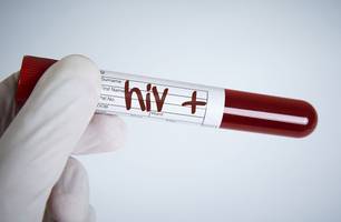 Dezembro Vermelho alerta para aumento de casos de Aids em jovens no Piauí (Foto: Reprodução)
