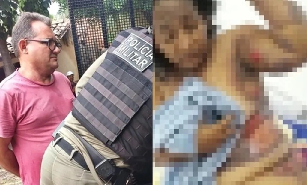 Homem é preso após jogar álcool e atear fogo na esposa