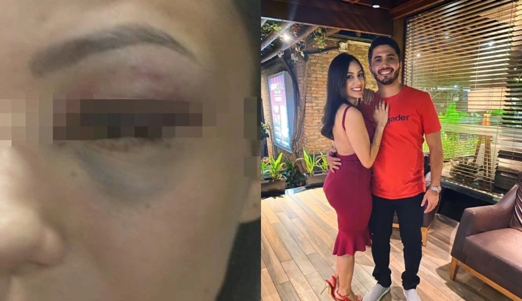 Mulher é espancada por ex-namorado e pode perder; ele é servidor do TJ-PI