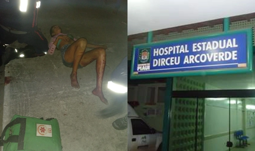Mulher escapa da morte após ser alvo de vários tiros em rua de Parnaíba