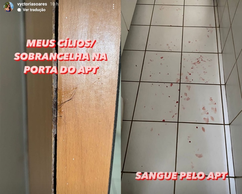 Jovem foi agredida pelo namorado em Teresina