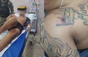 Homem é baleado no ombro (Foto: Reprodução/ Redes Sociais)