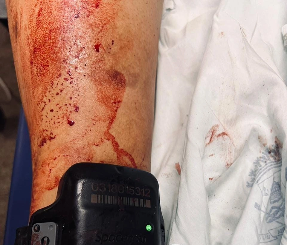 Jovem com tornozeleira que foi socorrido