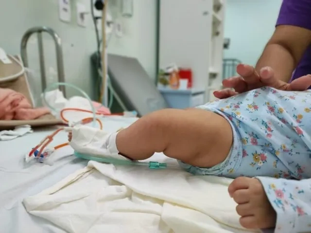 Sesapi vai abrir leitos pediátricos para enfrentamento de síndromes respiratórias