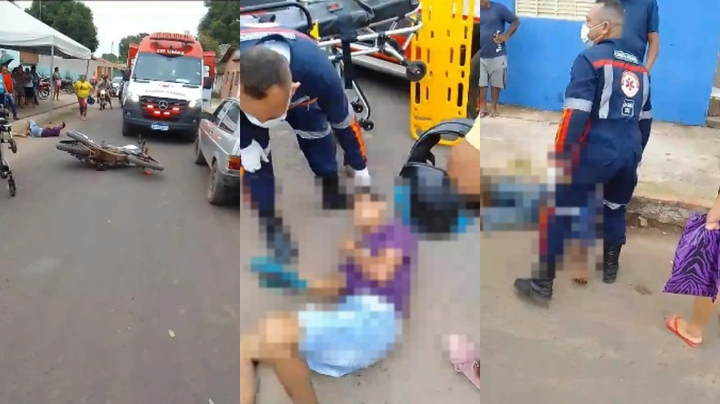 Acidente deixa homem em estado grave na cidade de Demerval Lobão