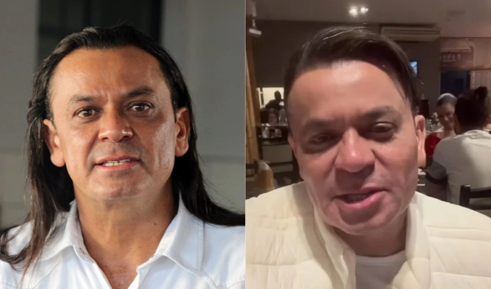 Frank Aguiar passa por harmonização e novo corte de cabelo