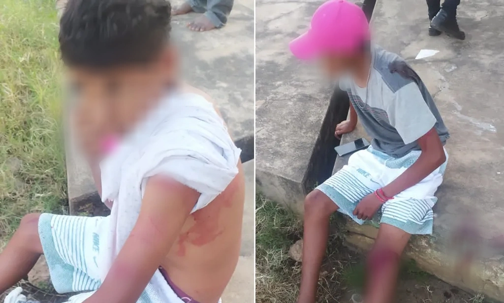 Jovens esfaqueiam menor por causa de vídeo íntimo