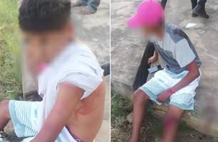 Jovens esfaqueiam menor por causa de vídeo íntimo (Foto: Divulgação/ PM-PI)