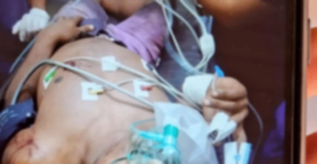 Jovem é baleado em Demerval Lobão