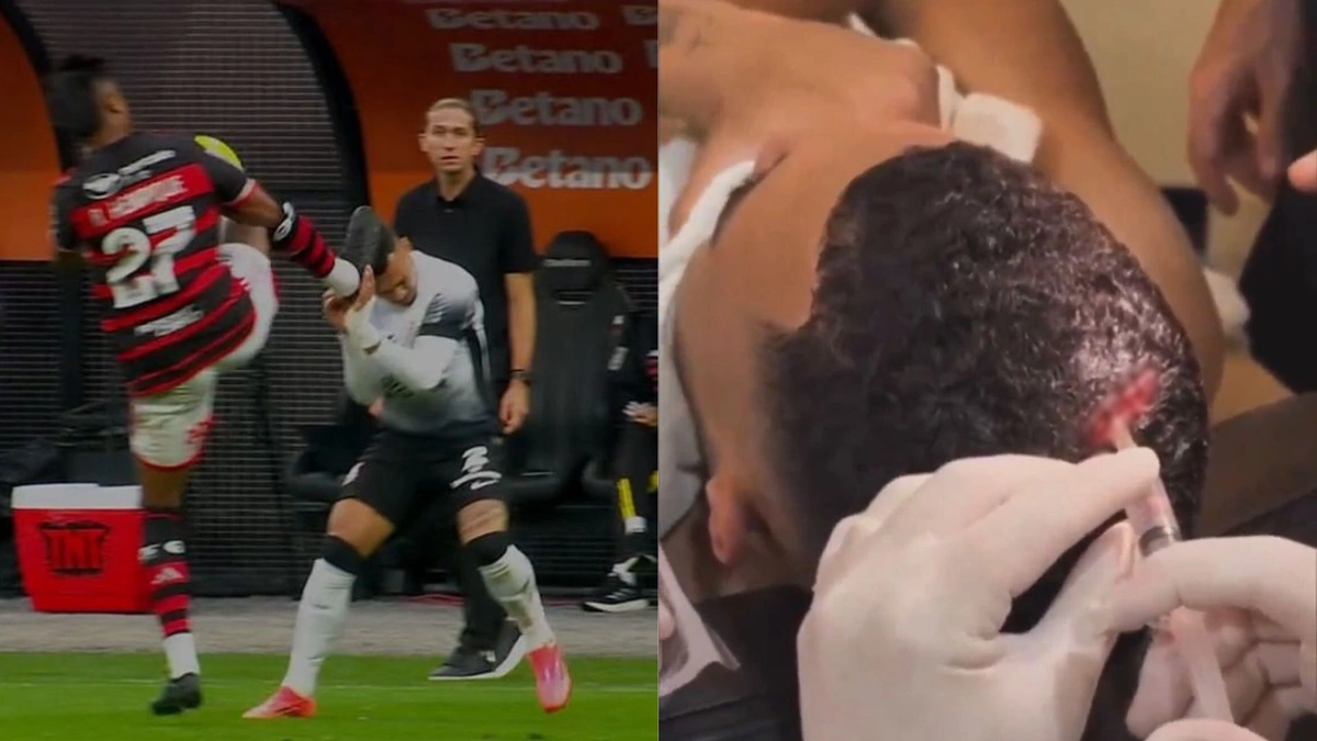 Entrade dura de Bruno Henrique em Matheuzinho