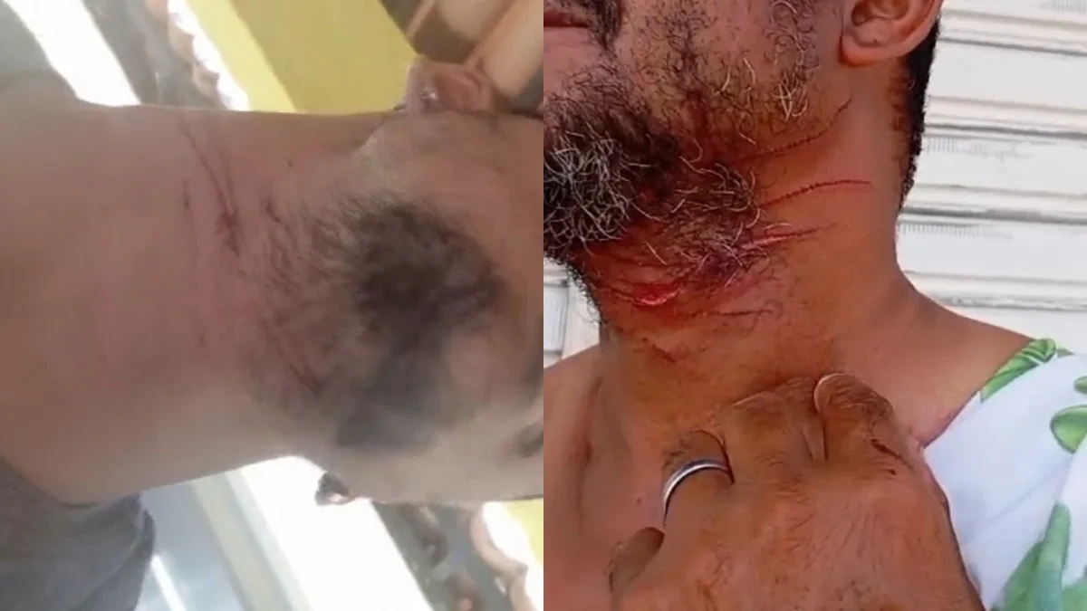 Arame farpado em estrada deixa motociclistas com ferimentos no pescoço em Pio IX