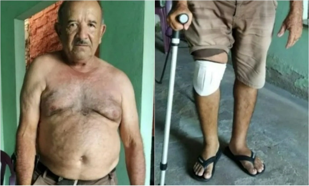 "Zezim" Messias foi assaltado e espancando dentro de casa em Barras
