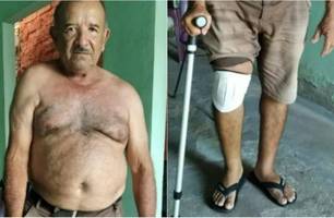 "Zezim" Messias foi assaltado e espancando dentro de casa em Barras (Foto: Reprodução)