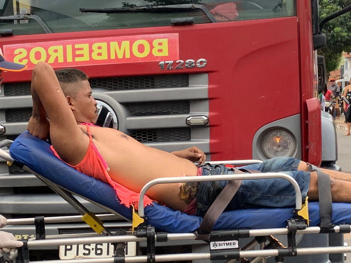 'Ceará' foi resgatado com vida, mas sofreu queimaduras de 3º grau