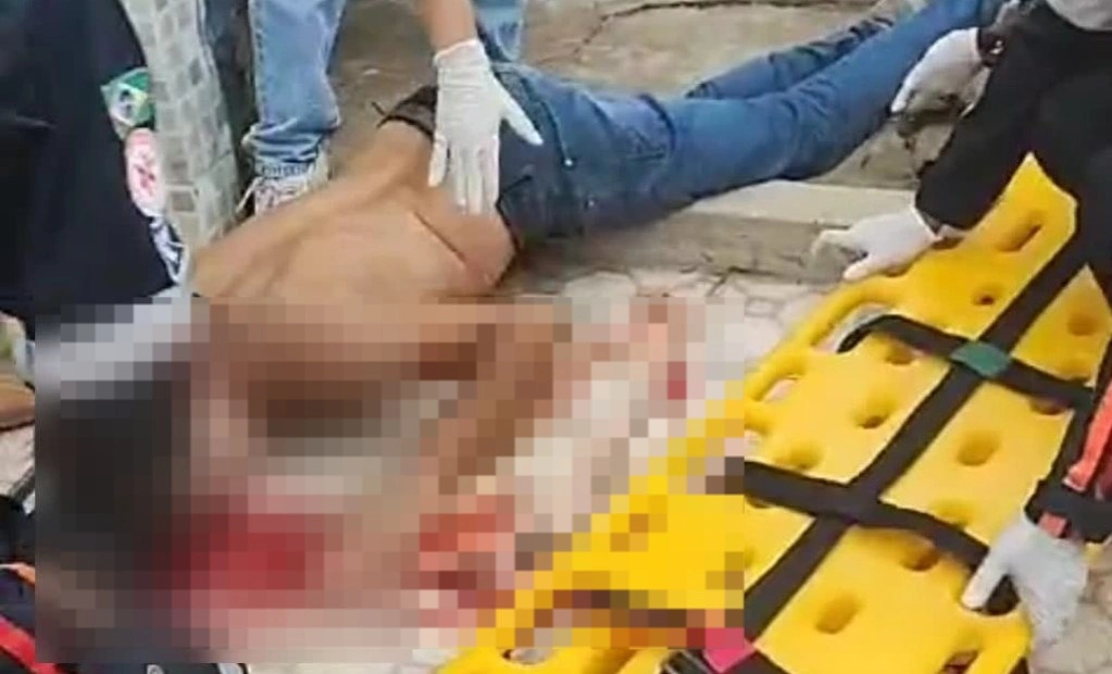Homem fica gravemente ferido após sofrer acidente de moto em Luzilândia
