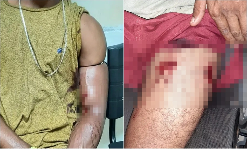 Jovens são baleados enquanto conversavam na calçada em José de Freitas
