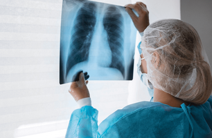 Tuberculose (Foto: Divulgação/Alepi)