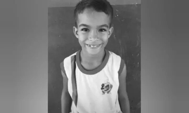 Criança morre devido as queimaduras