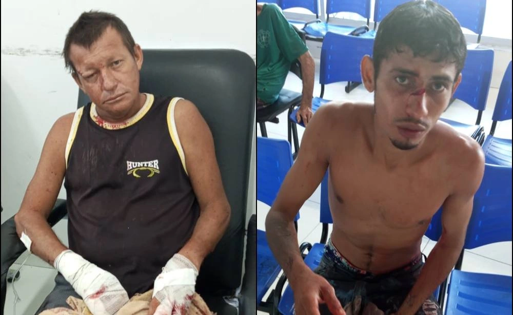Amigos se esfaqueiam durante bebedeira e acabam em hospital em Cocal