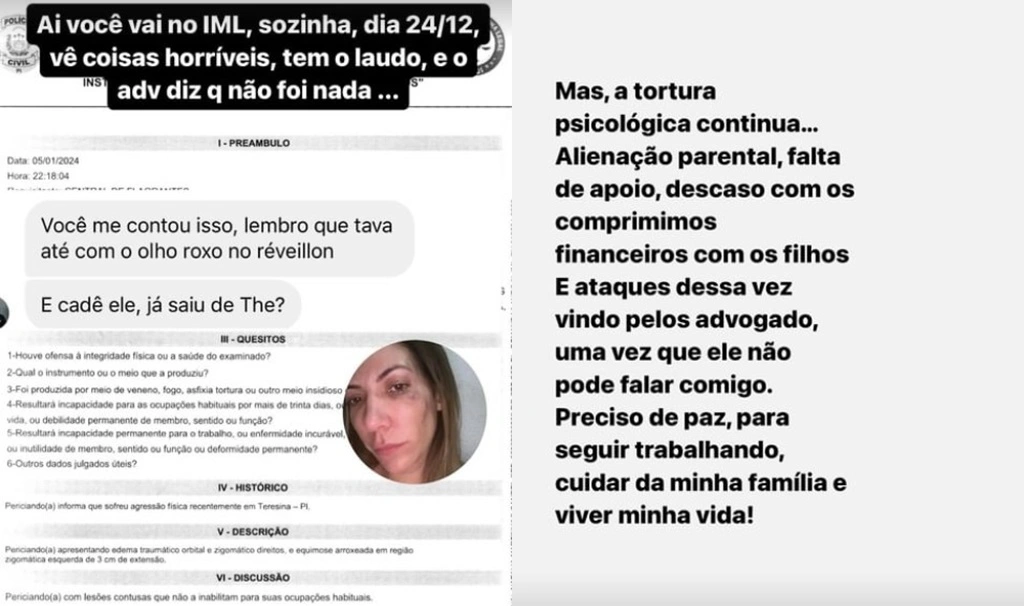 Ex-esposa de empresário italiano expõe supostas agressões durante o relacionamento