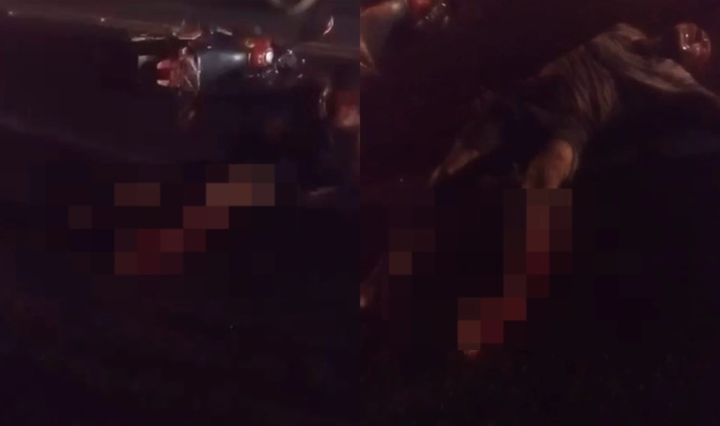 Mecânico sofre grave acidente de moto e fica com perna destroçada em Monsenhor Gil