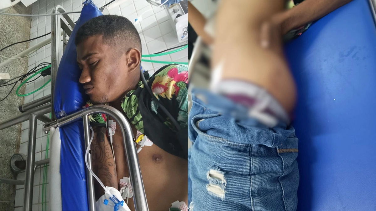 Criminoso tenta assaltar casa em Teresina e é baleado nas nádegas