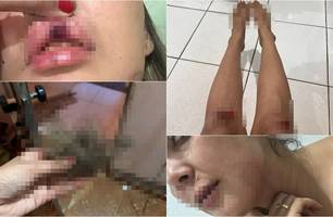 Mulher é brutalmente agredida pelo ex-namorado em via pública em Pedro II (Foto: Reprodução)