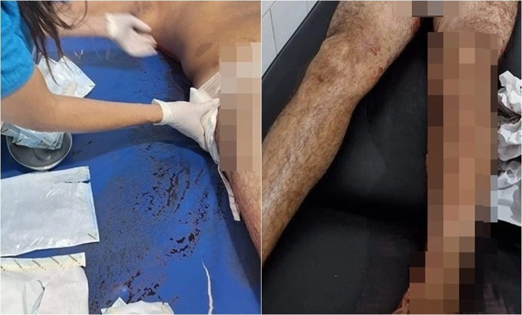 Irmãos são baleados em Regeneração
