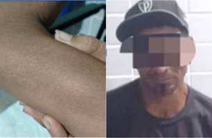 Mulher é agredida com cabo de enxada pelo próprio companheiro em Campo Maior (Foto: Reprodução/IG Notícias de Campo Maior)