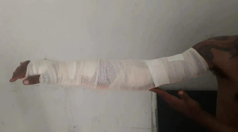 Homem é baleado no braço durante tentativa de homicídio em município no Piauí