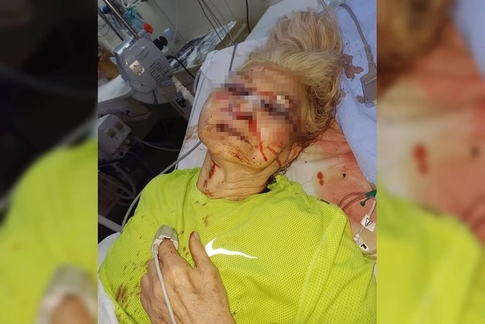 Idosa agredida no DF