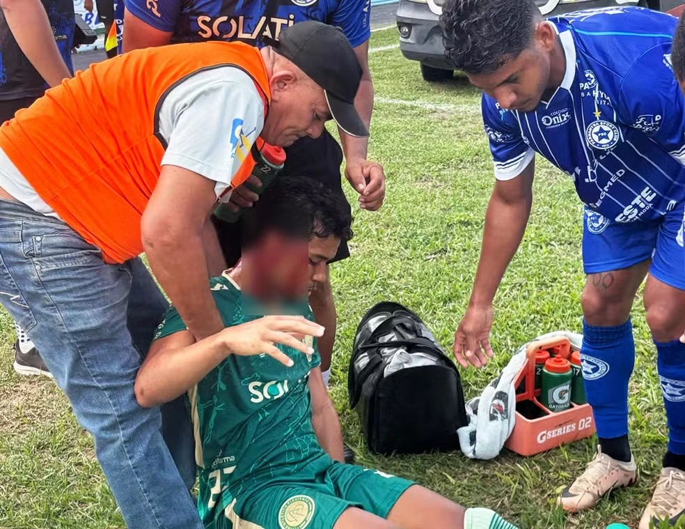 Atleta do Atlético-PI escorrega e bate rosto em poço durante jogo contra Parnahyba