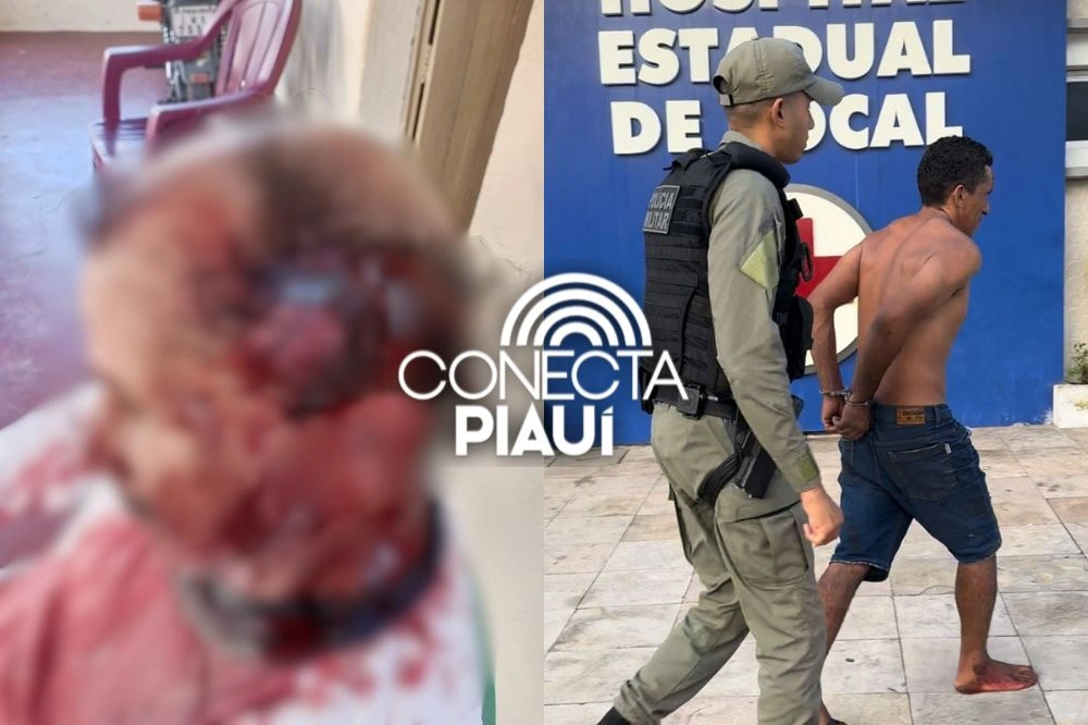 Homem fica gravemente ferido ao reagir a assalto e ser atacado com foice no Piauí