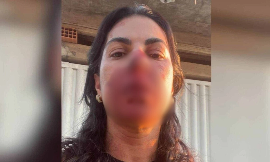 Oficial de Justiça denuncia agressão por sargento da PM enquanto cumpria mandado