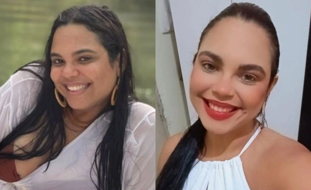Enfermeira atropelada por estudante de medicina presta depoimento à Polícia