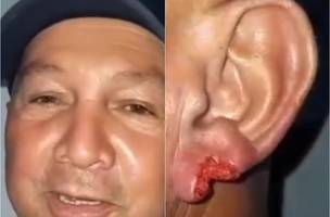 Após beijo, mulher arranca pedaço da orelha de homem durante festa em Piripiri (Foto: Reprodução/ Piripiri Repórter)