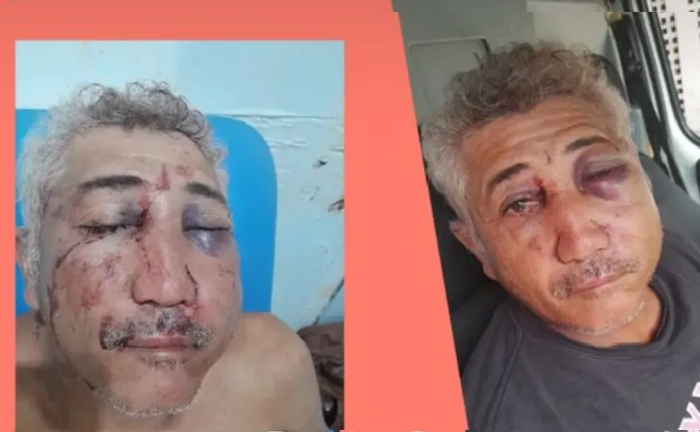 Homem é ferido por motociclista que estava dando 'grau' em Barras