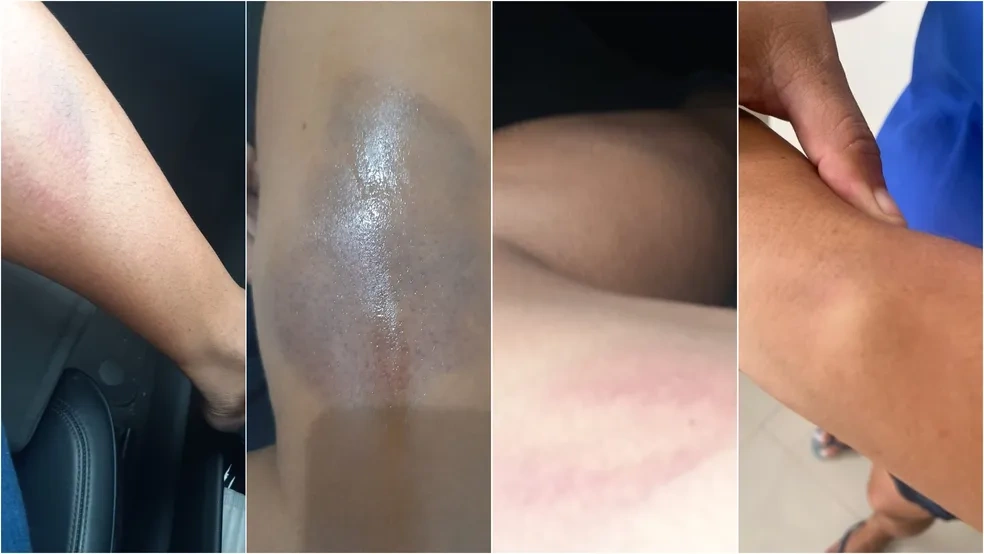 Justiça condena supermercado Mateus por tortura em cliente