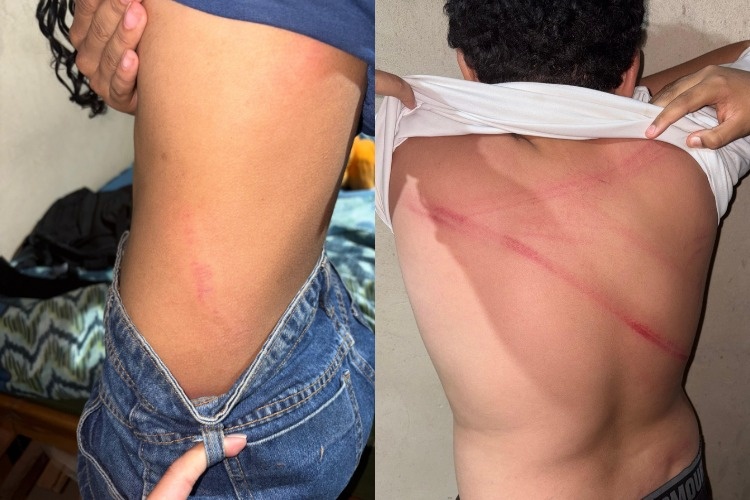 Agressões sofridas pelos adolescentes