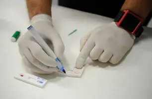 Exame hepatite (Foto: Agência Brasil)