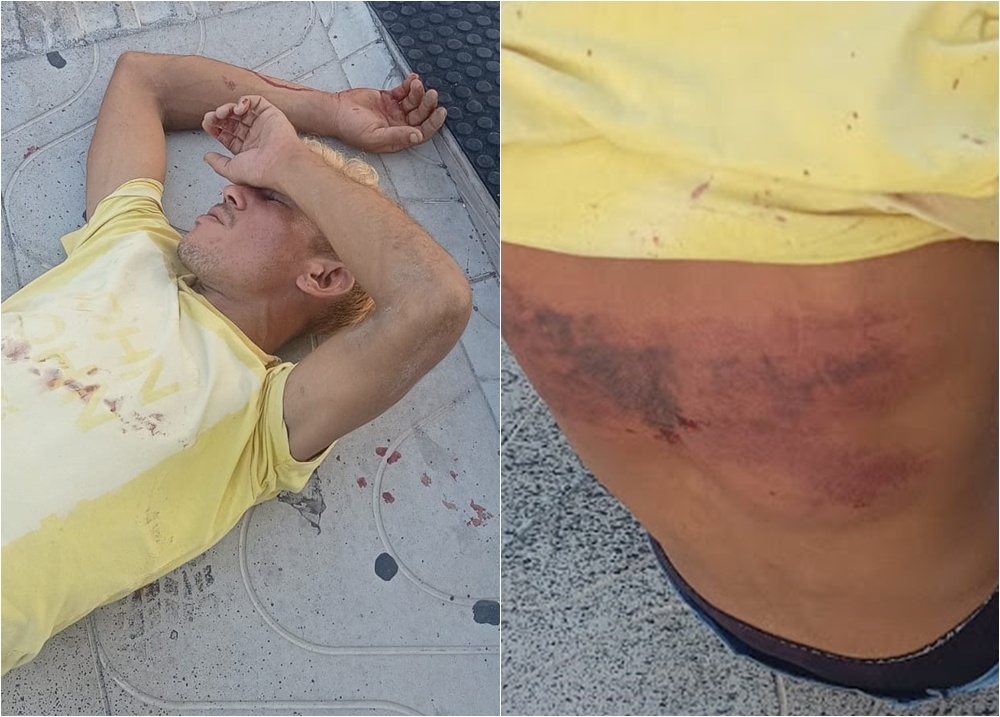 Homem é sequestrado, espancado e abandonado em via pública em Parnaíba