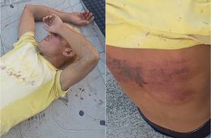 Homem é sequestrado, espancado e abandonado em via pública em Parnaíba (Foto: Reprodução)