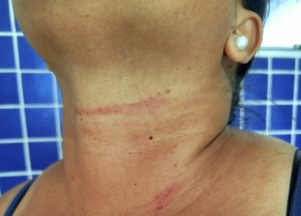 Mulher foge de agressor e aciona PM em Monte Alegre