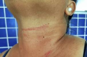 Mulher foge de agressor e aciona PM em Monte Alegre (Foto: Reprodução/PM/Portal Gurguéia)