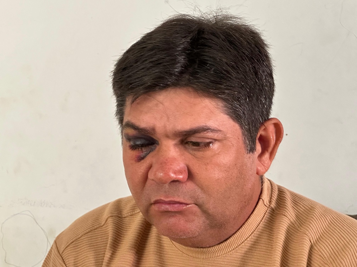 Servidor agredido por ex-vereador em São Raimundo Nonato relata como tudo aconteceu