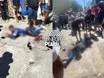 Suspeito baleado em arrastão no Dirceu é menor de idade; tiro quebrou a perna